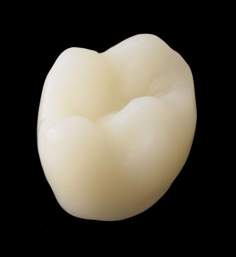 Straumann CARES CADCAM Extended application range: Variobase 1 coping: prosthetic for selected 2 non- Straumann implant platforms using genuine abutment-implant connections CADCAM screw-retained bars