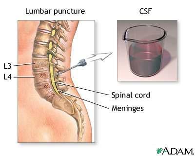Cerebrospinal Fluid (CSF) Colorless fluid Contains proteins, glucose, urea, salts, & some WBCs
