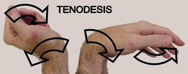 Characteristics of Two Joint Muscles Advantage of active insufficiency: Tendon muscle action (tenodesis): is the movement that occur in one joint due to passive tension of the muscle in the other