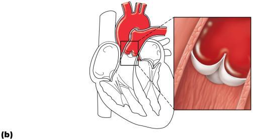 The function of the semilunar (SL) s Aorta trunk As ventricles contract and intraventricular pressure rises, blood is pushed up against semilunar s, forcing them open.