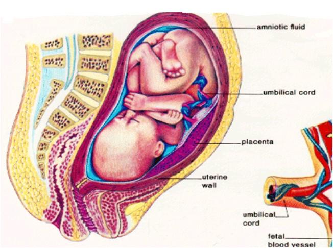 Example # 3 Childbirth.