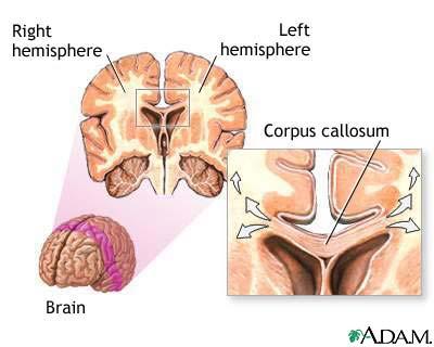 mo to r a re a Frontal lobe re a Cerebrum - divided into four lobes The right and left cerebral hemispheres interconnected by the corpus