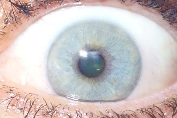 The Sclera is more fluid and changes quickly, indicating more what is going on presently.
