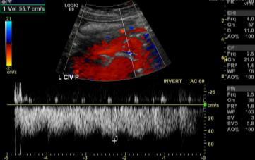 Transabdominal Ultrasound Step 1