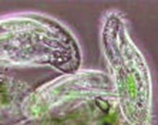 PARASITES Protozoa Flea s Scabies