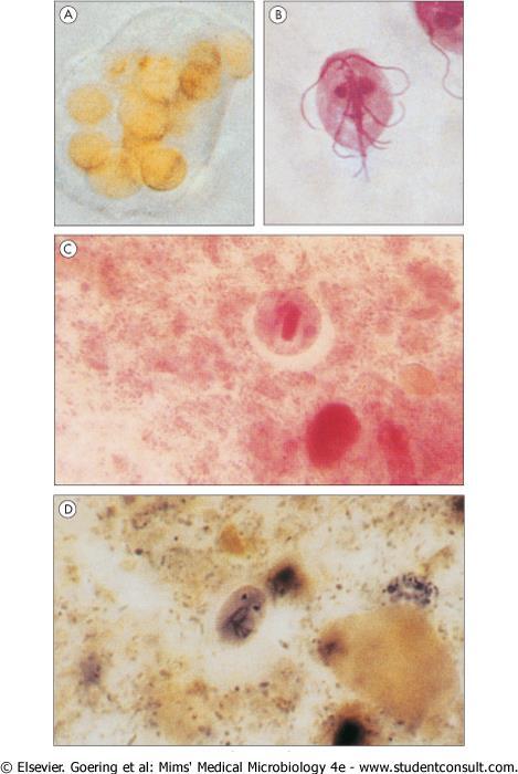 Protozoan infections of the gastrointestinal tract (A) Entamoeba histolytica.