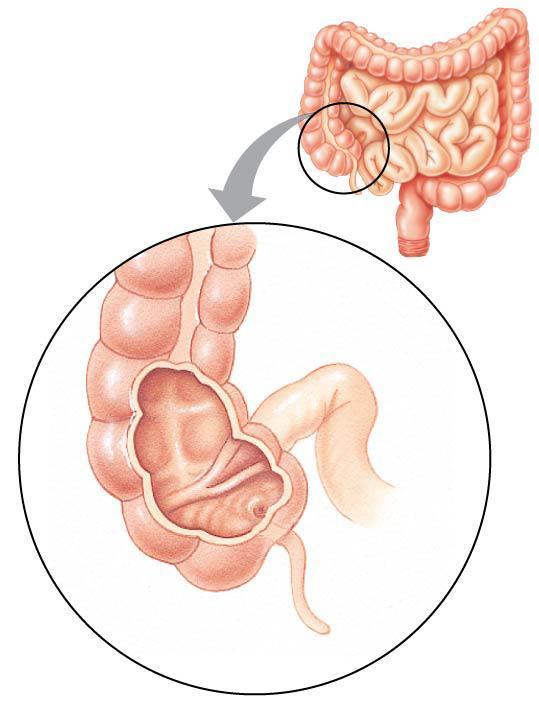 Processing in the Large Intestine The large intestine consists of the cecum, colon & rectum: the cecum aids in the fermentation of plant material and is connected to the appendix which has a role in