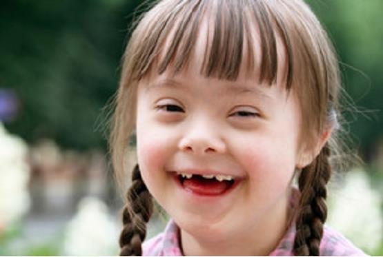 Down Syndrome: An Extra Chromosome 21 Typically, the nucleus