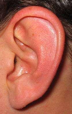 Otic Ear