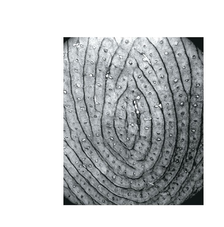 form friction ridges of fingerprints
