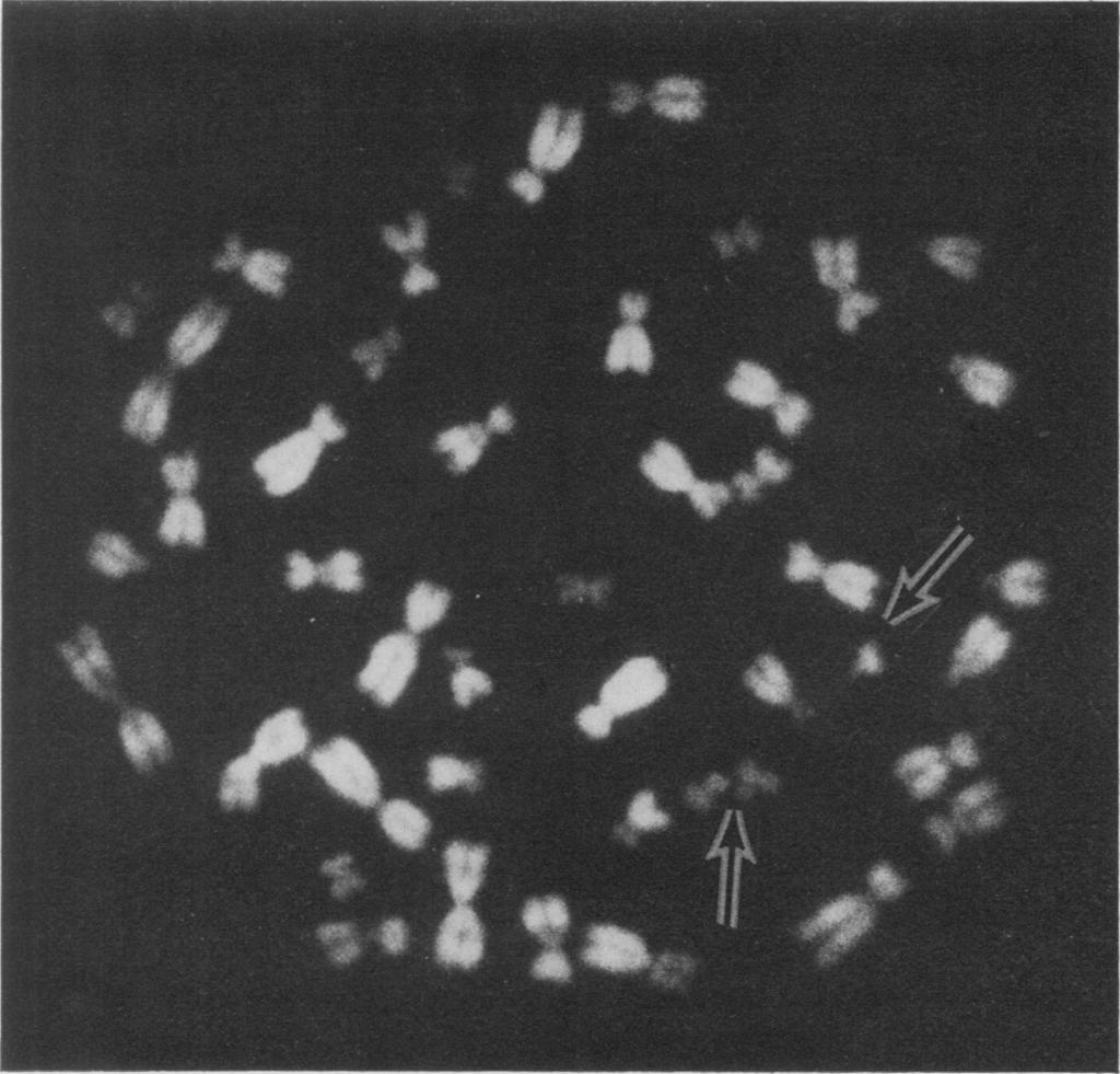 FIG. 4. Two weakly fluorescent chromosomes No. 22 and one chromosome No. 21 with strong fluorescence.