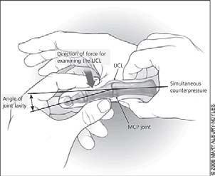 s Thumb) Valgus force at MCP with thumb AB