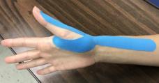 4-6 weeks post-operatively Home Program: Daily/nightly splint wear Active/Passive