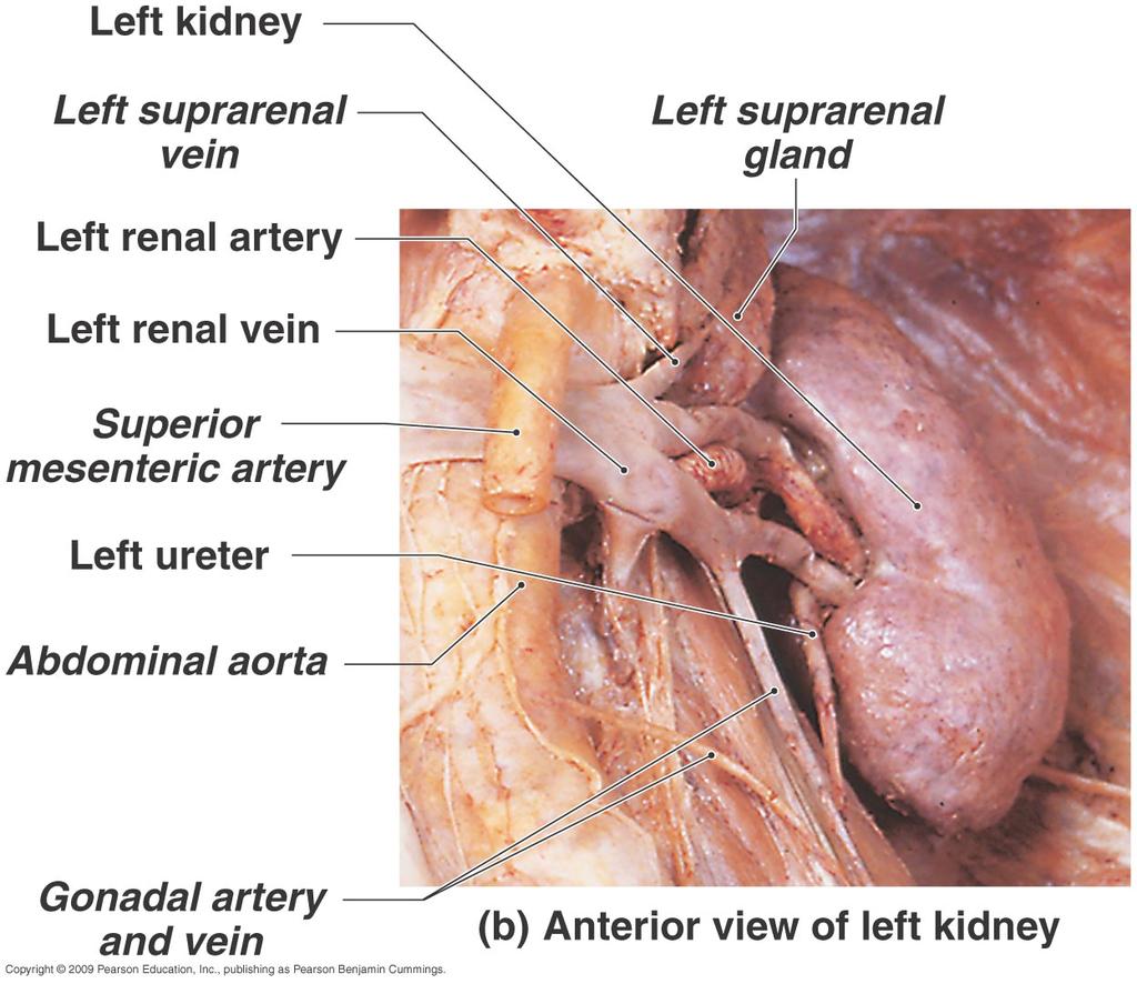 Kidney Gross Anatomy Retroperitoneal Anterior surface covered with peritoneum Posterior surface directly against posterior abdominal wall