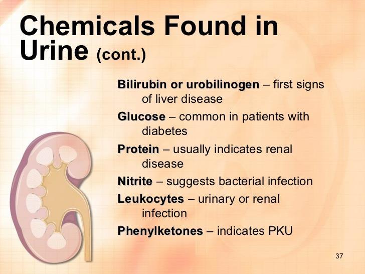 Other chemicals found in urine. Food, dehydration, and drugs can also affect these tests.
