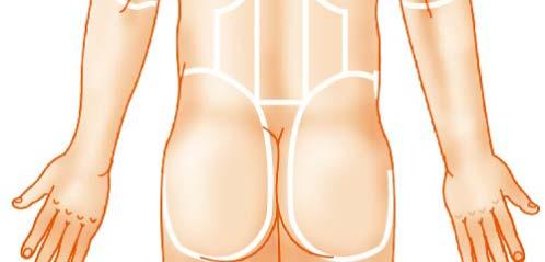 dorsal (back) Olecranal (back of elbow) Lumbar (loin) Sacral (between hips) Gluteal (buttock) Perineal (region between the anus