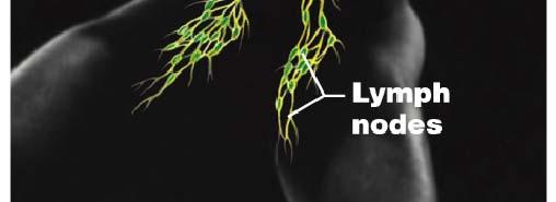 Disposes of debris in the lymphatic stream