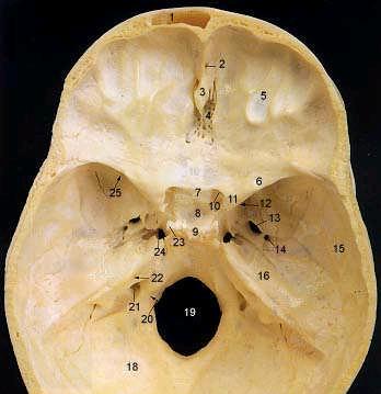 1. Frontal Sinus 2. Foramen Cecum 3. Crista Galli 4. Cribriform Plate 5. Anterior Cranial Fossa 6. Lesser Wing of Sphenoid 7. Chiasmatic Groove 8.