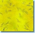 Effect on mycoflora of high-moisture grain fresh frisch Getreidekonservierung mit KOFA GRAIN ph5 0 Lagerdauer (Wochen) wheat, 21.