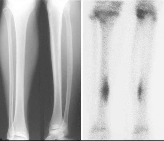 Radiograph and Bone