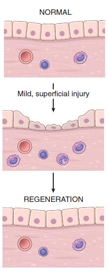 Regeneration Some tissues are able to replace the damaged cells and essentially return to a normal state Occurs by proliferation of