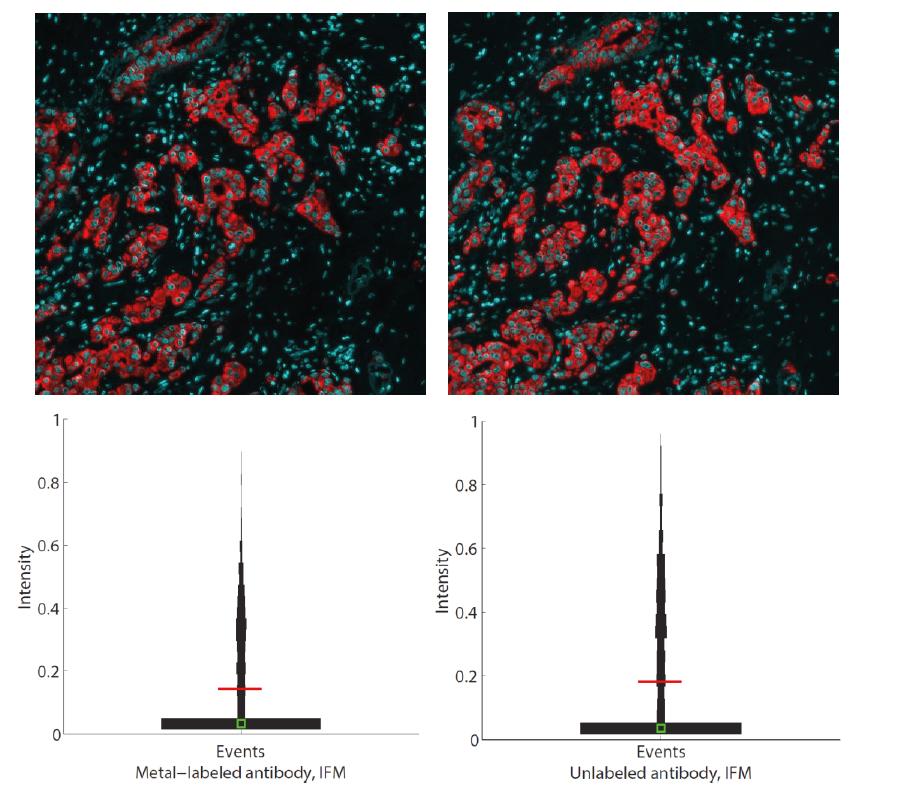 Highly multiplexed imaging of tumor tissues with subcellular resolution by mass cytometry (Giessen et al, 2014) 1I.
