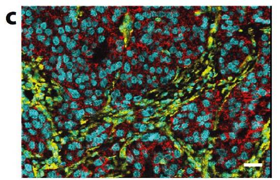 Highly multiplexed imaging of tumor tissues with subcellular