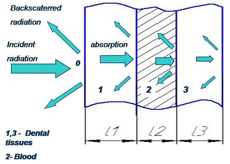 Figure 4 describes the phenomenological model of interaction between infrared radiation and dental tissues. Figure 4. Interaction between infrared radiation and dental tissue.