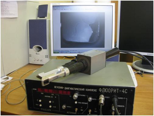images, automated detection of blood vessels and quantification of vascular structures.