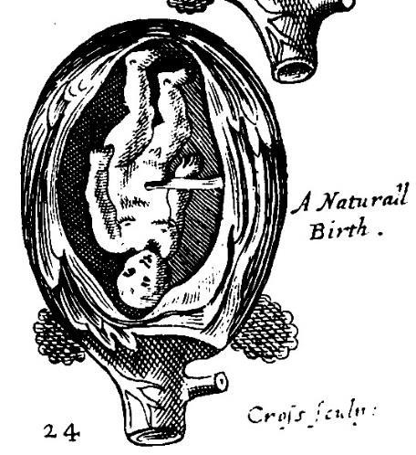 Illustrations shown floating freely in a spacious uterus.