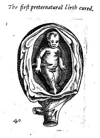 Illustrations layered uterus was apparently adapted from a uterine image displayed by Vesalius (1543).