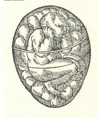 Rueff, fetus with placental band. Figure 4.