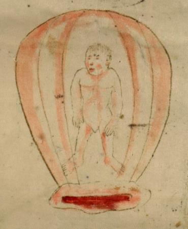 Illustrations birth figures conveyed similar information to those of the Speculum Matricis concerning the fetuses prior to childbirth, while allowing for variations in artistic interpretation.