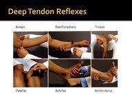 extension) + 3 Brisker than average; possibly, but not necessarily indicative of disease + 2 Average; normal + 1 Somewhat diminished; low normal No response Deep Tendon Reflexes Biceps reflex