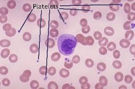 Immune Thrombocytopenic Purpura (Idiopathic) Thrombocytopenic Purpura Immune ThrombocytoPenia Isolated