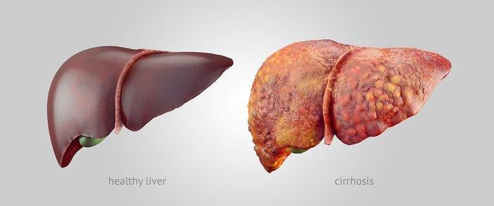 The liver converts excess amino acids in our bloodstream into other