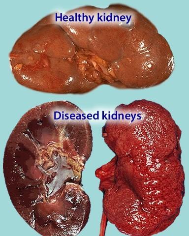 EXCRETORY SYSTEM Kidneys Filters wastes out of blood. Reabsorbs nutrients and water.