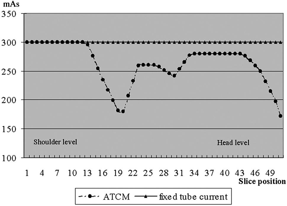 Materials and Methods Fig 1. Graph illustrating tube current reduction by combined ATCM, which tailors the radiation dose to the individual patient.