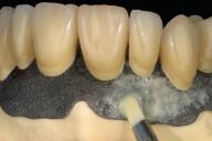 2. Application 2-1 Layering technique for gingival reproduction Basic build-up Individual build-up Pre-Opaque Opaque GUM-T GUM-L (GUM-D / GUM-Or) F-GUM-R (F-GUM-V) F-W (F-ODA3) 2-2 Pre-treatments