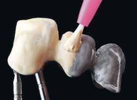 This new primer creates extremely strong bonds between resins and all dental alloys, zirconia or alumina