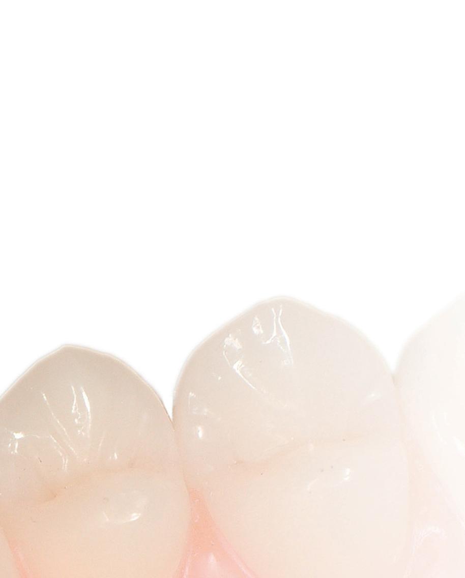 OUTSTANDING FEATURES THANKS TO HOMOGENEOUS MICROSTRUCTURES Light-curing tooth restoring materials such as micro-filled veneering materials