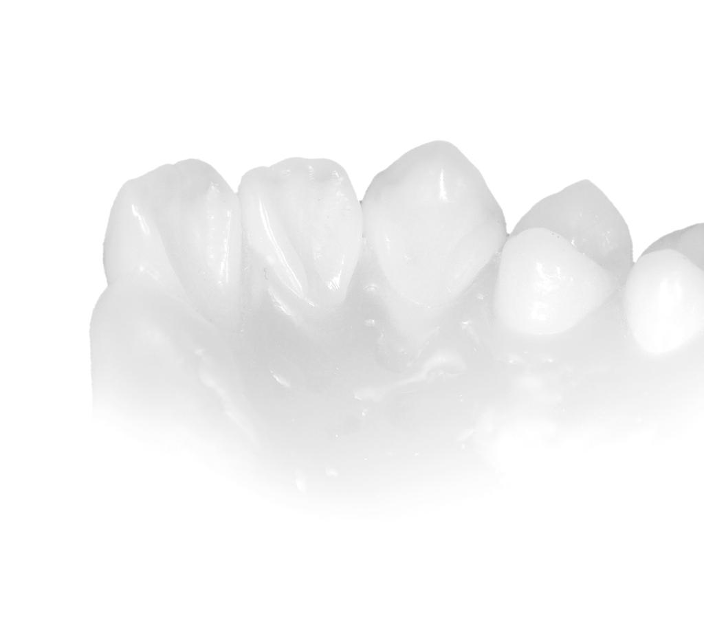 UNRESTRICTED INDICATIONS FOR ANTERIOR AND POSTERIOR RESTORATIONS Adequate material for any indication CERAMAGE combines a natural colour reproduction with an extraordinary strength and elasticity and