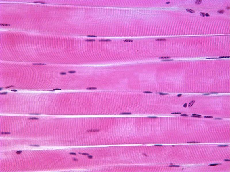 Muscle Tissue There are three types of muscle tissue: skeletal muscle, cardiac muscle, and smooth muscle. Skeletal Muscle Identification: Teased or l.s. section shows distinct, very large, straight fibers that are striated (striped) and multinucleate (many nuclei).