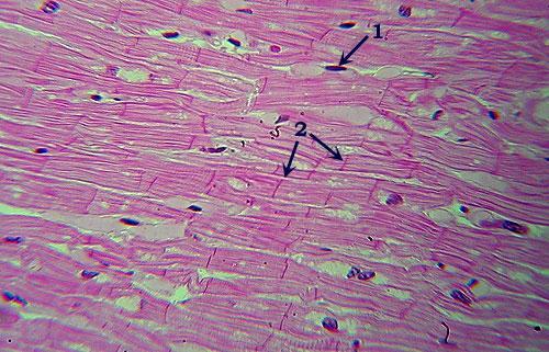 Where Located: skeletal muscles; under voluntary control. Cardiac Muscle Identification: Note faint striations across fibers.