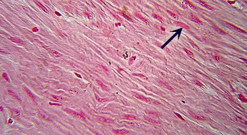 Smooth Muscle Identification: Muscle cells are packed tightly together (no gaps between cells) and usually not distinct. Nuclei (arrow) may or may not be visible. Note lack of striations.