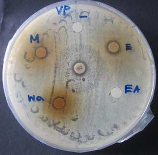 Clear Zone B cerius S sp E coli V parahaemolyticus P