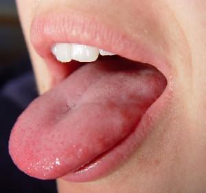 Taste Taste buds sensory receptors for taste Located mostly in the