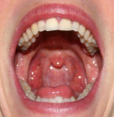 The Mouth AKA: oral cavity or buccal cavity