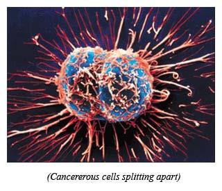 Cancer: Uncontrolled Cell Growth Cancer: a disorder in which body cells lose the ability to control cell growth How do cancer cells differ from other cells?