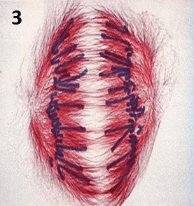 Anaphase Sister chromatids are pulled apart to opposite poles of the cell by the spindle fibers